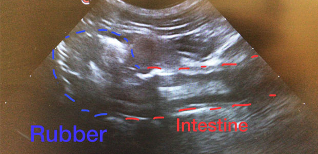ultrasound shot of rubber in intestine