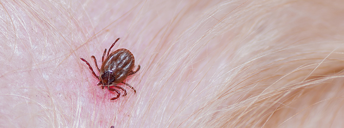 Header photo of a tick embedded in a dog’s skin, a common parasite causing irritation and potential health risks in pets.